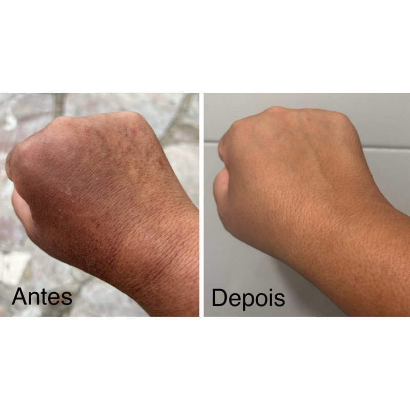 Hidratante Clareador Remove Melasmas e Manchas Escuras - Natural e Vegano - Deixa a Pele Com Toque Seco