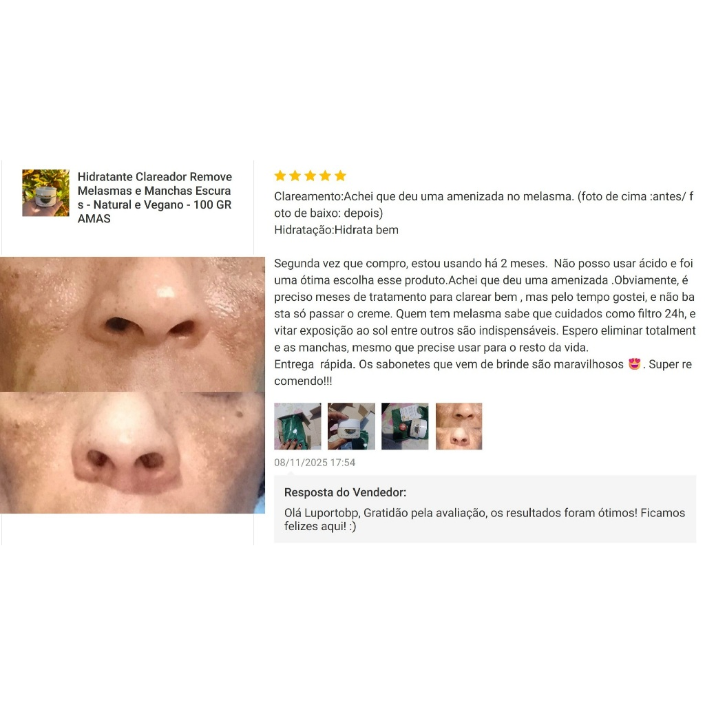 Hidratante Clareador Remove Melasmas e Manchas Escuras - Natural e Vegano - Deixa a Pele Com Toque Seco